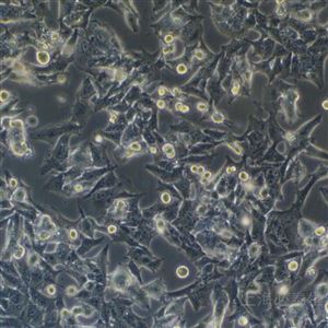 BT120小鼠胶质瘤细胞GL261（种属鉴定）