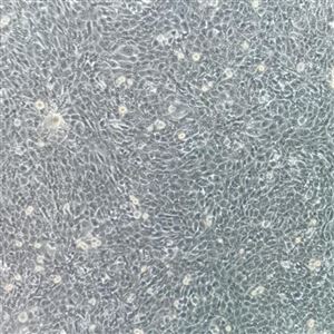 BT1734T1小鼠乳腺癌细胞T25